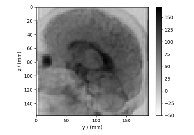 Diffusion tensor MRI, 3D{6} dataset