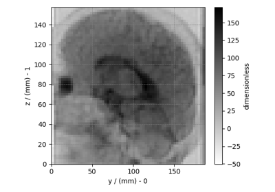 Diffusion tensor MRI, 3D{6} dataset